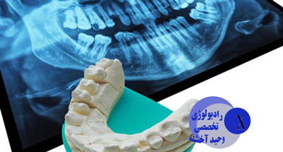 انواع رادیوگرافی داخل و خارج دهانی در دندانپزشکی