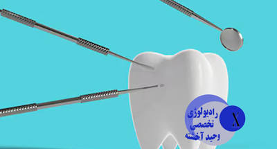 چند وقت یک بار باید عکس دندان گرفت؟